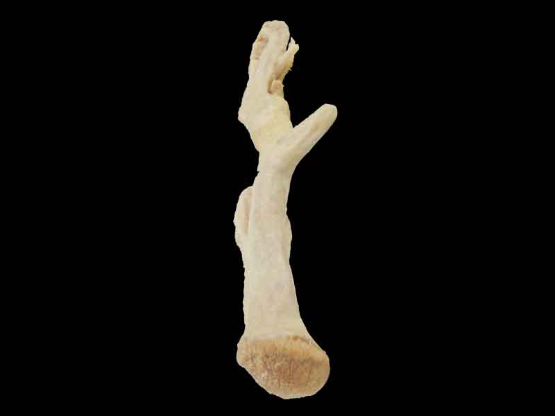 corpus cavernosum penis human plastination suppliers