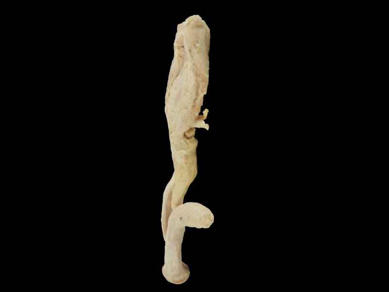 corpus cavernosum penis plastinated cadaver
