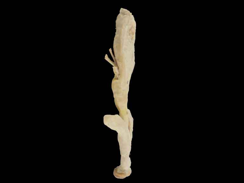 corpus cavernosum penis plastination