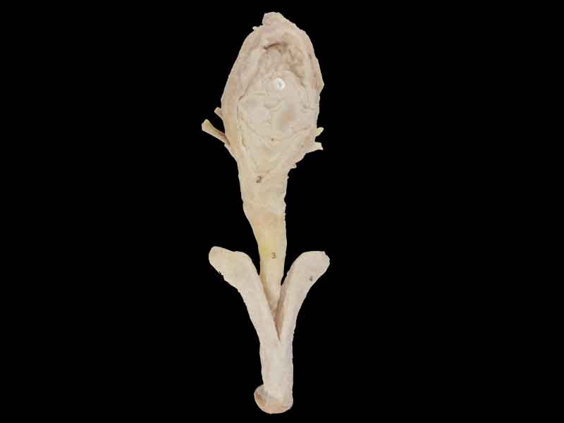 corpus cavernosum penis plsatinated organs