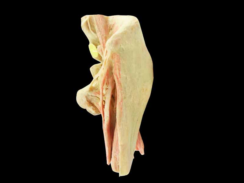 Female internal genital organs medical specimen