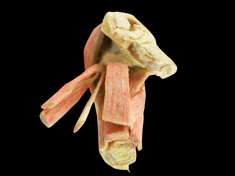 Female internal genital organs plastinated specimen
