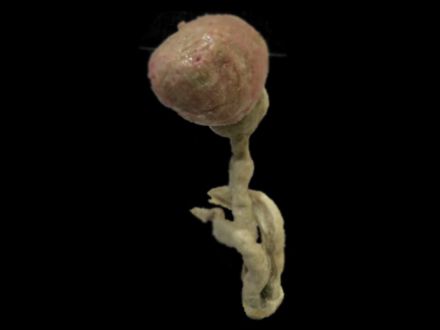 Male urinary bladder plastinated specimens 