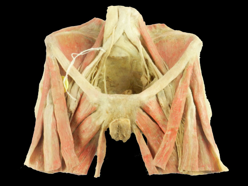 Muscles of female perineum anatomic specimen