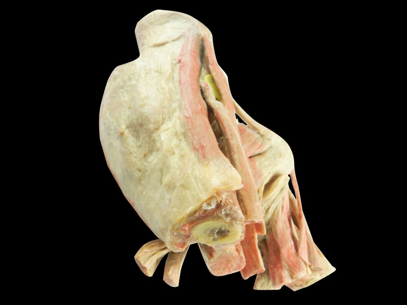 Muscles of female perineum human plastination supplier