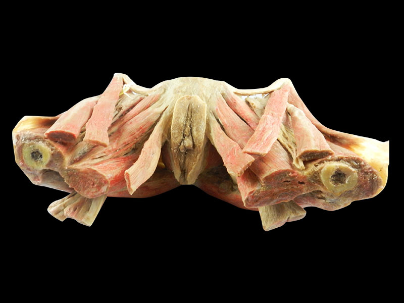 Muscles of female perineum plastinated body