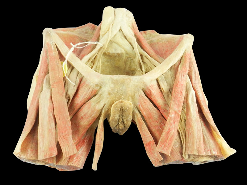 Muscles of female perineum plastinated organs