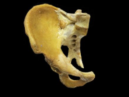 Sagittal section of male pelvis plastinated specimens