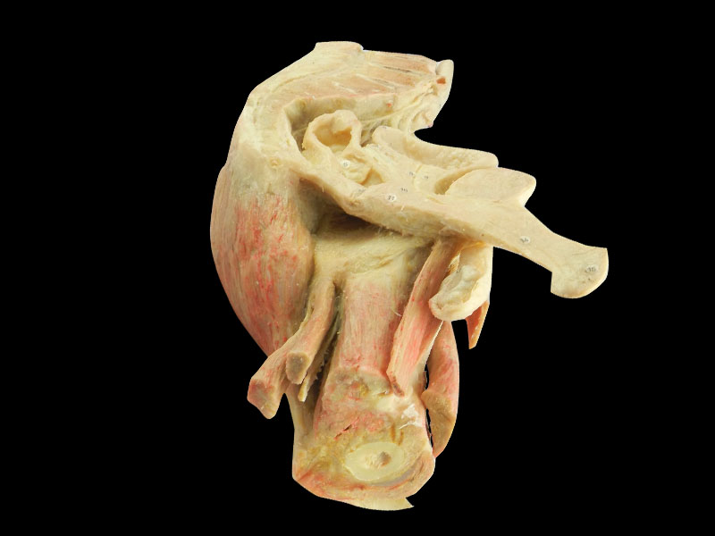 Sagittal section of male plevic plastinated body