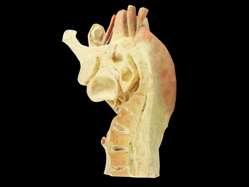 Sagittal section of male plevic plastination