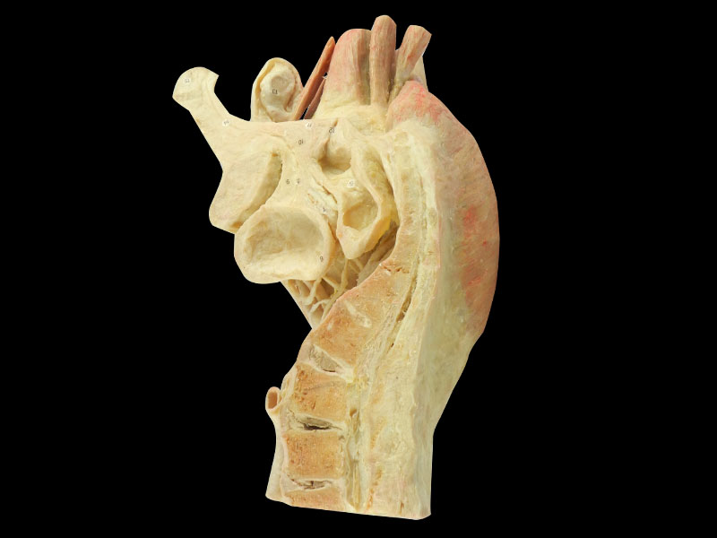 Sagittal section of male plevic