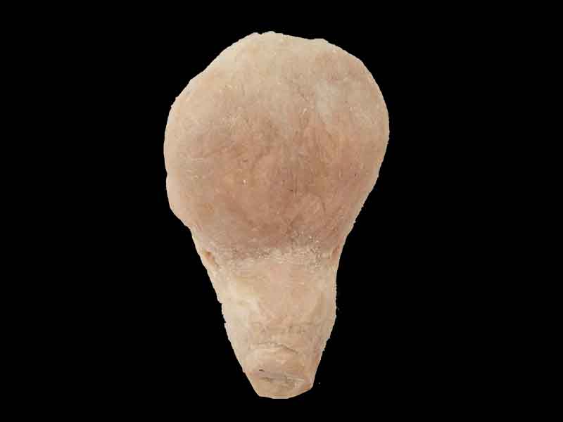 urinary bladder
