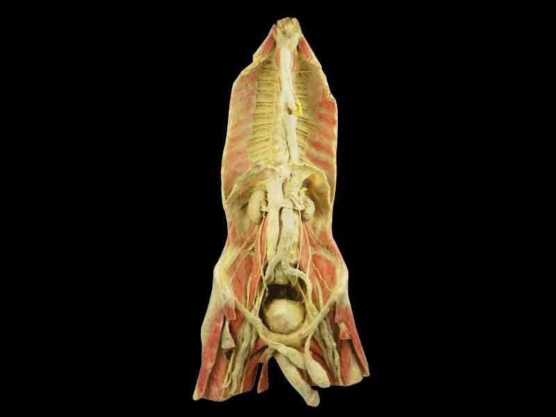 Chest and abdomen plastination