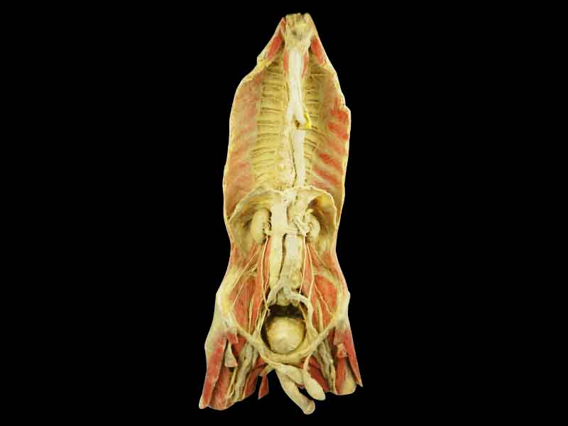 Posterior wall structure of chest and abdomen plastinated specimen