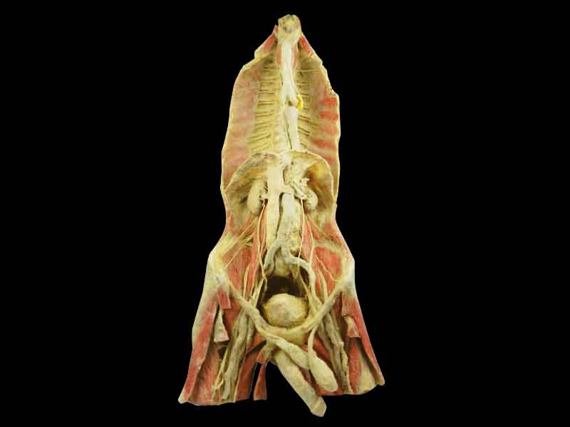 Posterior wall structure of chest and abdomen plastination
