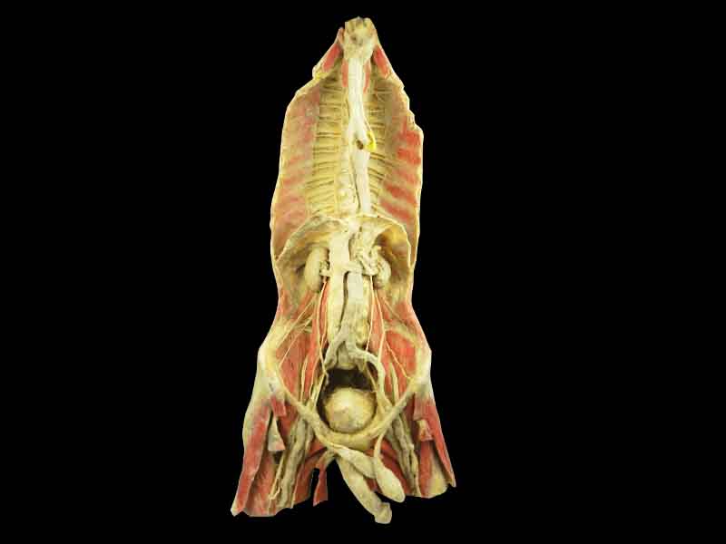 Chest and abdomen plastinated specimen teaching specimen