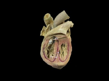 Cardiac conduction system plastinated specimens