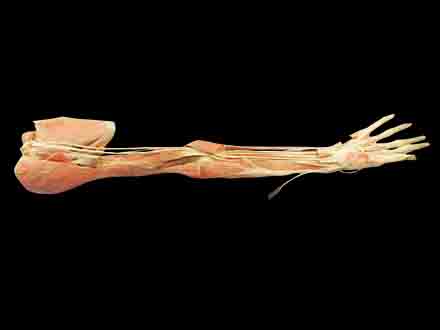 Deep arteries  of upper limb