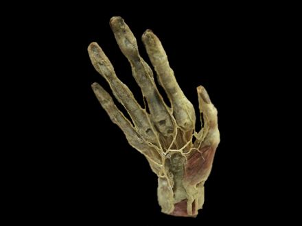 Deep palmar arch plastinated specimens