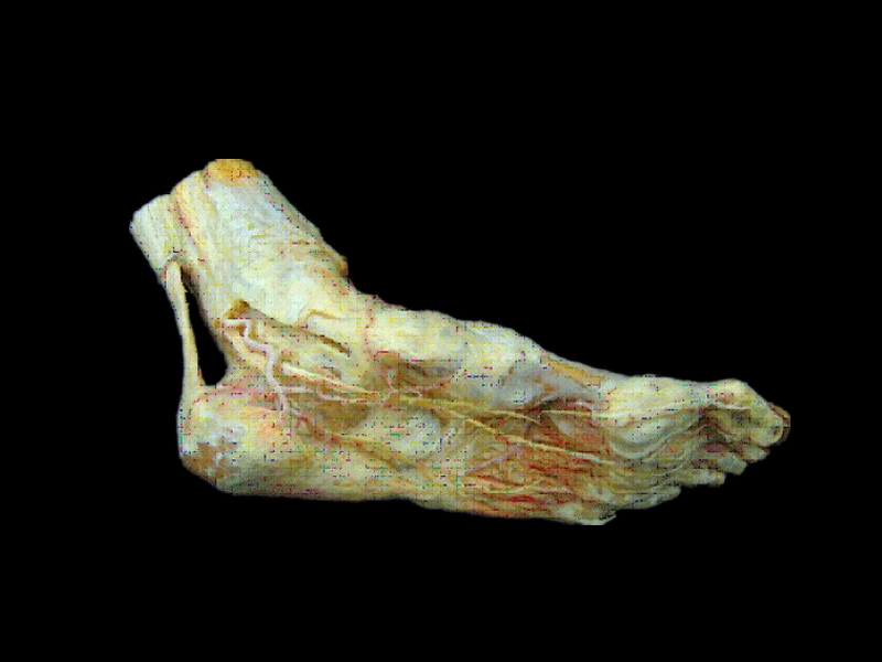 Foot artery and its branches plastinated specimens