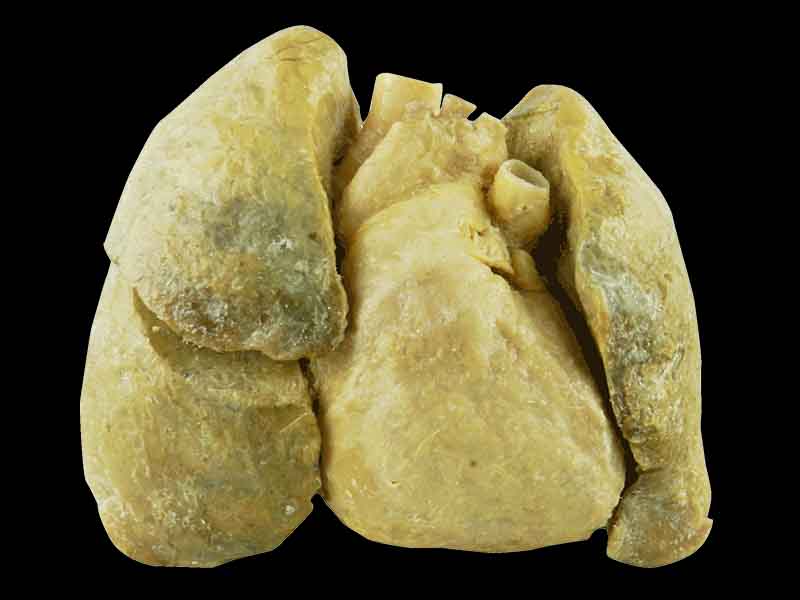 Heart and 2 lungs for sale