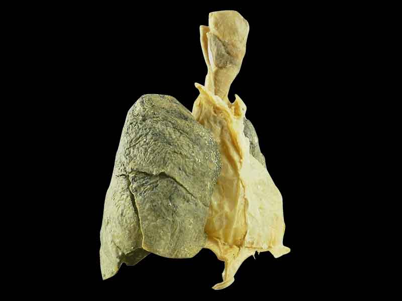 Heart and 2 lungs plastinated specimen