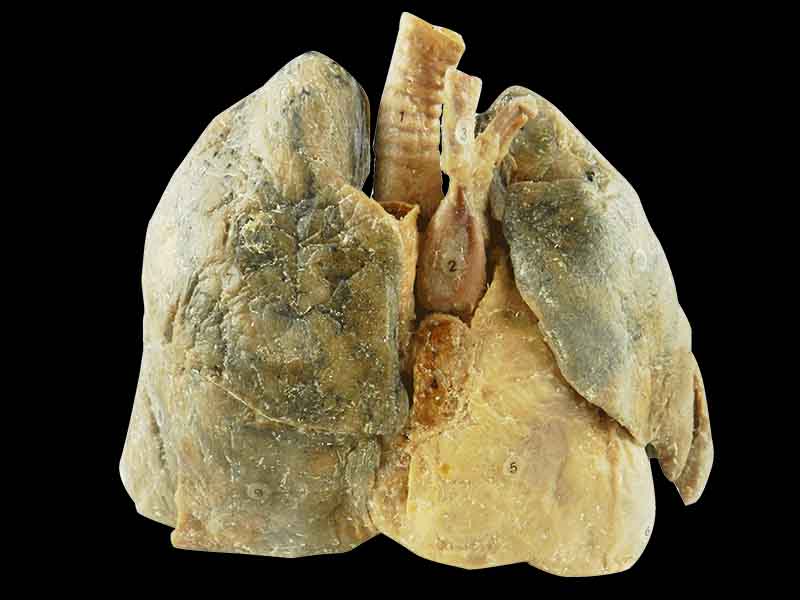 Heart and 2 lungs teaching specimen