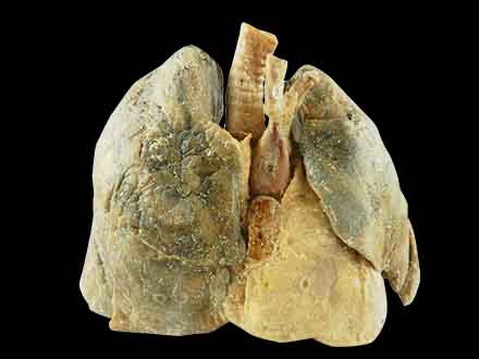 Heart and the 2 lungs