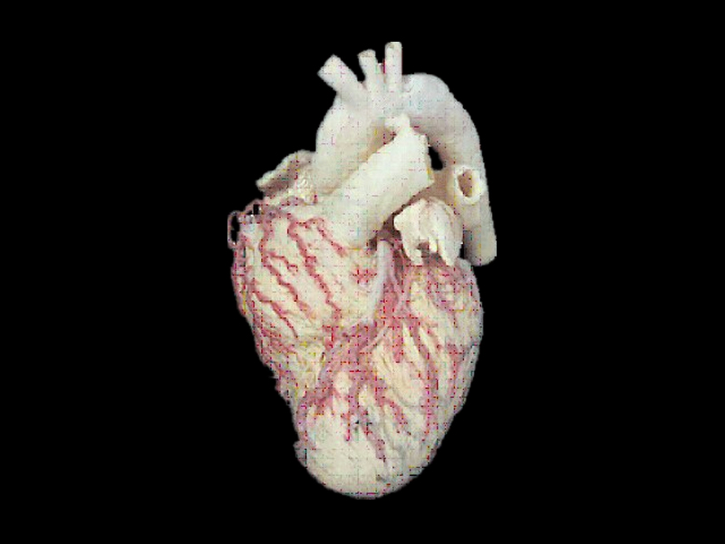 Heart and vascular appearance plastinated specimens 