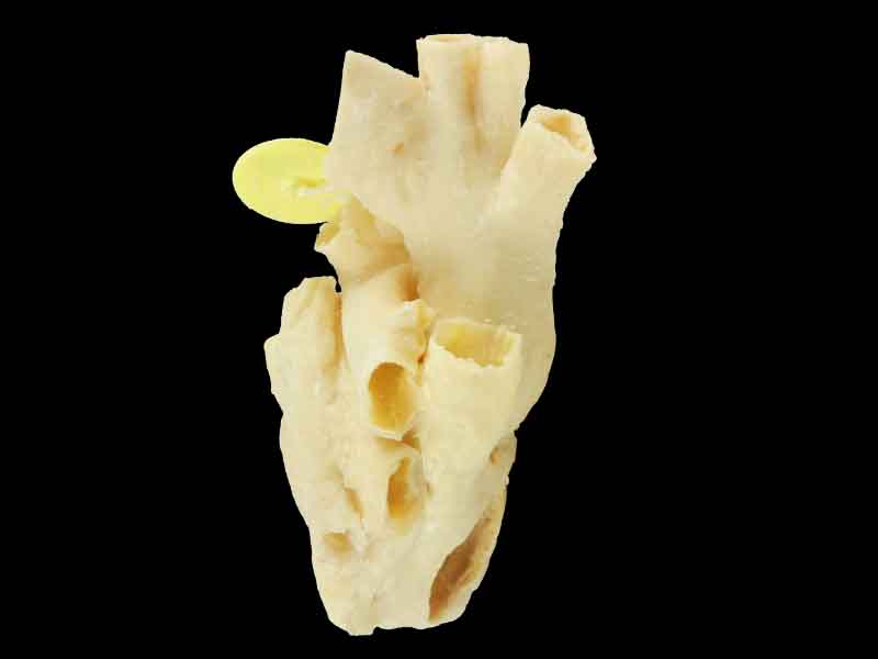 Heart cavity structure human specimen