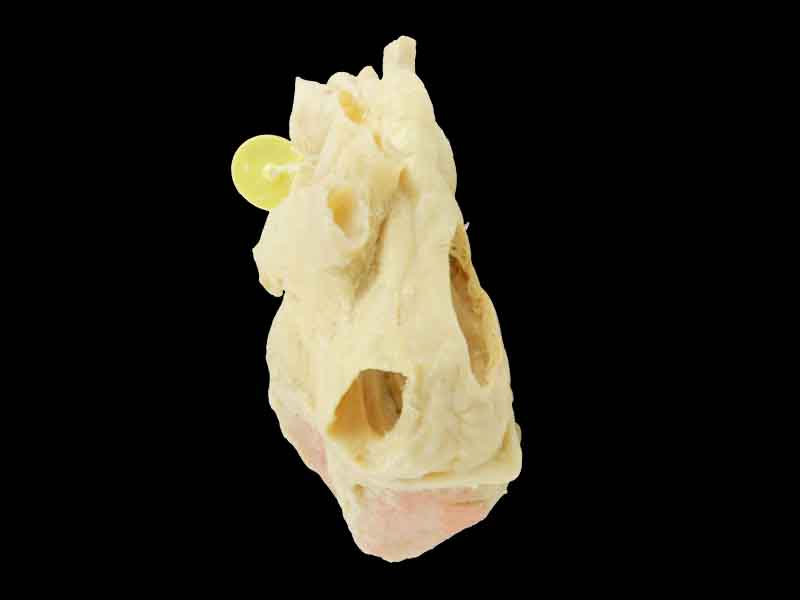 Heart cavity structure plastination specimen