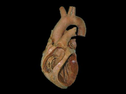 Heart chamber plastinated specimens