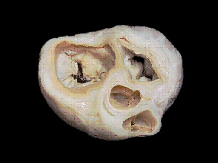 valves and fibrous rings of the heartplastinated specimens