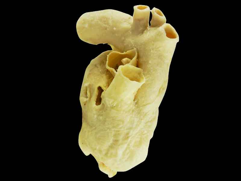 Pericardium anatomical specimen for teaching