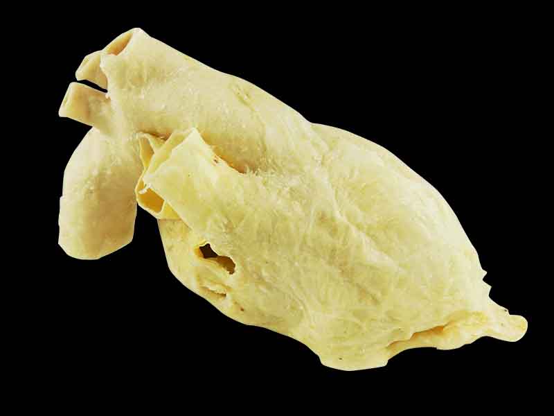 Pericardium plastination