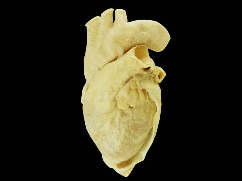 Pericardium specimen for sale