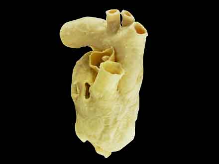 Pericardium