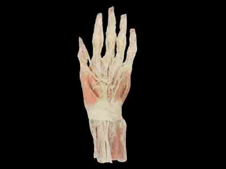 Superficial Hand arteries