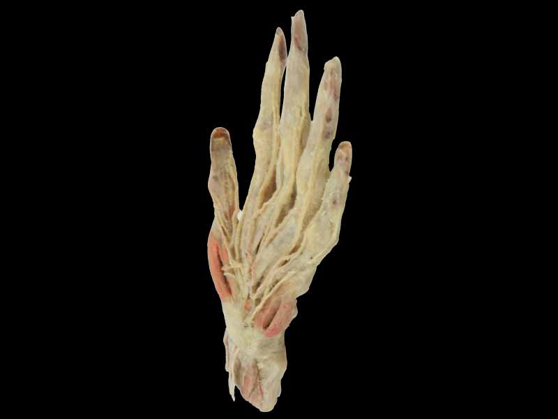 Superficial Hand arteries plastination