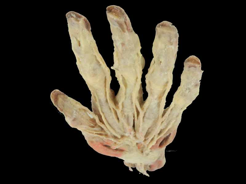 Superficial Hand arteries specimen for sale