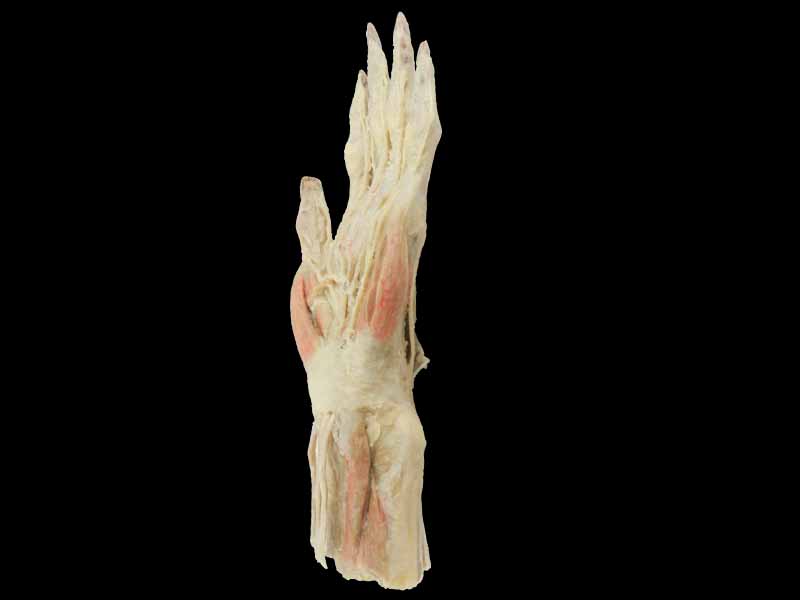 Superficial Hand arteries teaching specimen