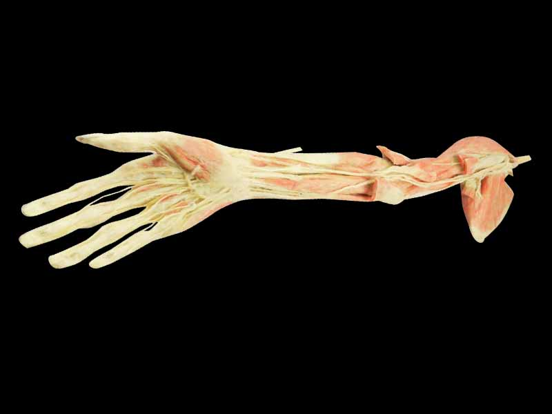 Upper limb arteries medical specimen