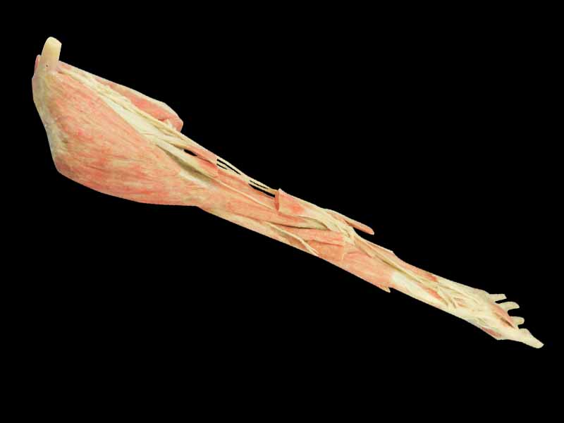 Upper limb arteries plastinated specimen