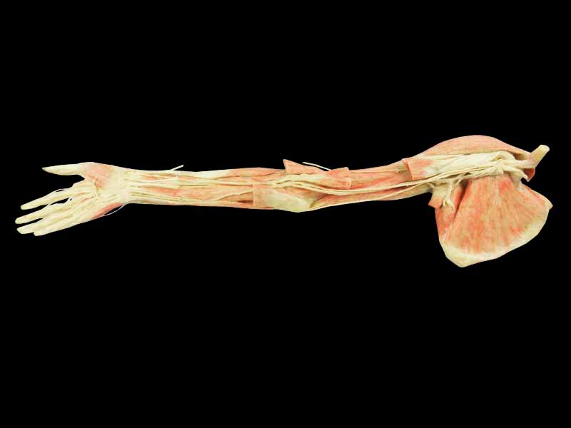 Upper limb arteries teaching specimen