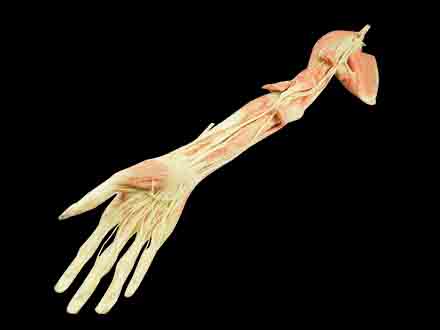 Upper limb artery plastination specimen