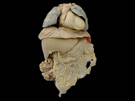 viscera plastinated specimen