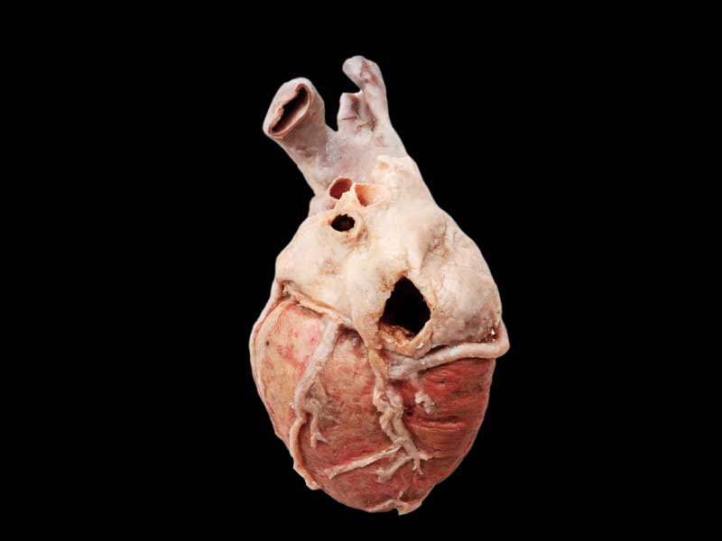 Whole heart plastinated specimen