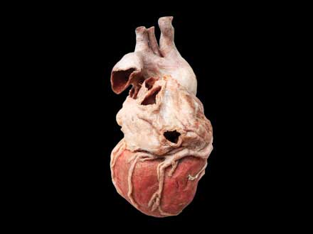 Whole heart plastinated specimen