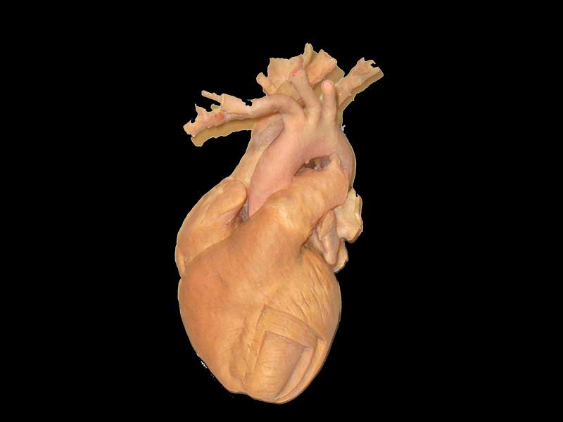 whole heart plastination specimen