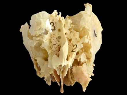 human ethmoid bone